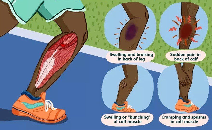 sports-injury-bims-hospital