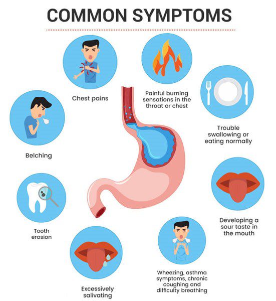 gastroesophageal-reflux-disease-gerd-bims-hospital